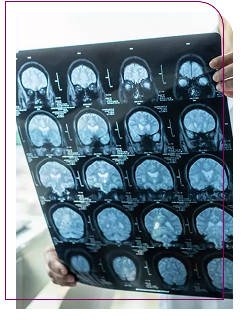 pos-graduacao-neuropsicologia