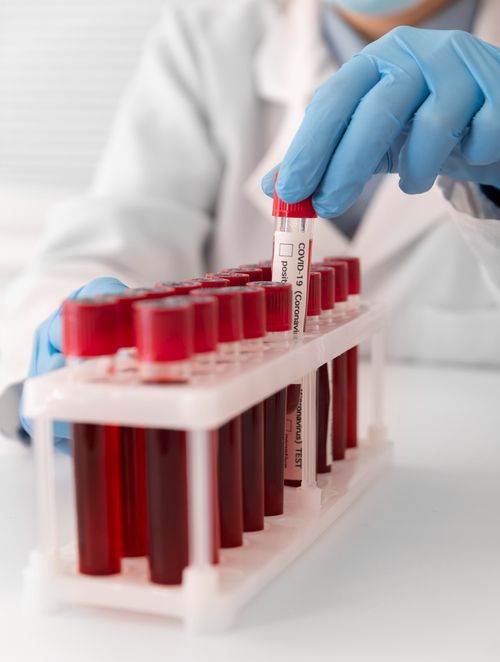 Recolha de material para experimento